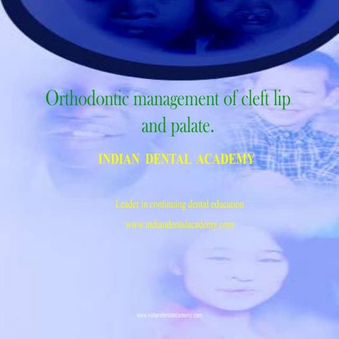 Ortho management of clp /certified fixed orthodontic courses by Indian dental...