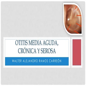 Otitis media aguda, crónica y serosa
