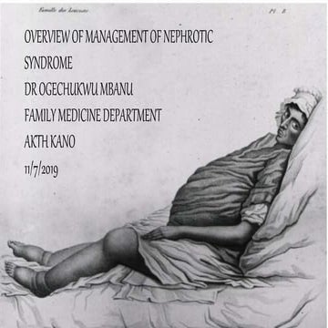 Overview of management of nephrotic syndrom