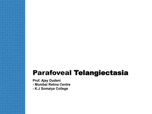 Parafoveal telangiectasia-- AJAY DUDANI