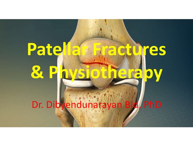 Patellar fractures & Physiotherapy