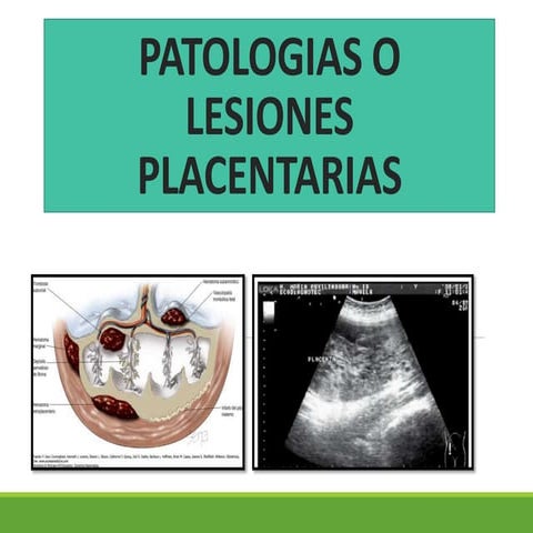 Patologias o lesiones placentarias