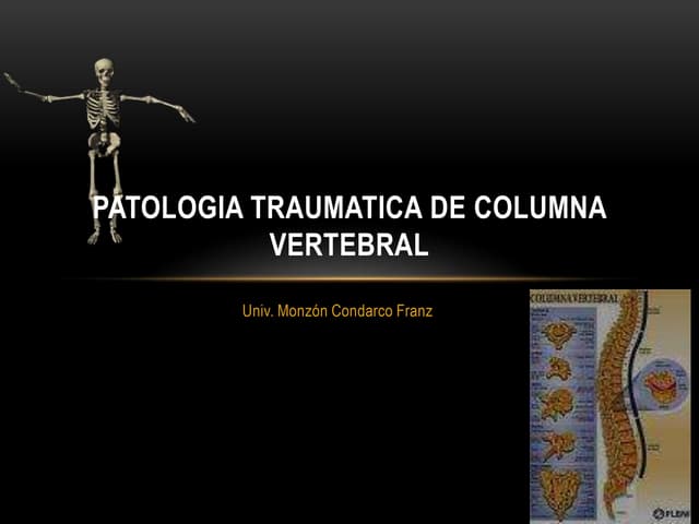 Patologia traumatica de columna vertebral
