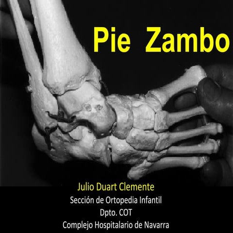 Pie zambo 