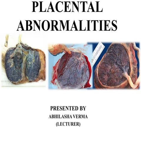 Placenta abnormalities