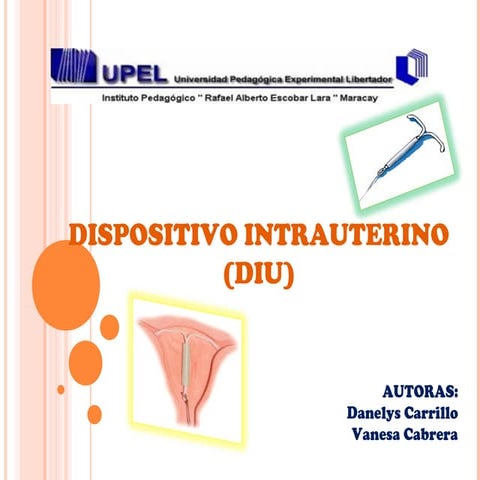 presentacion del metodo Anticonceptivo DIU