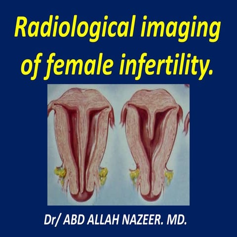 Presentation1.pptx, radiological imaging of female infertility.
