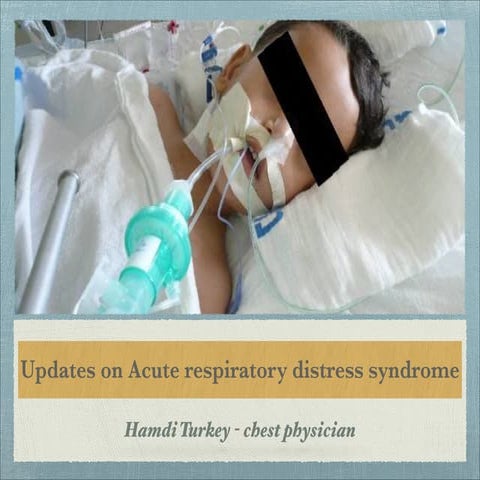 Updates on Acute respiratory distress syndrome