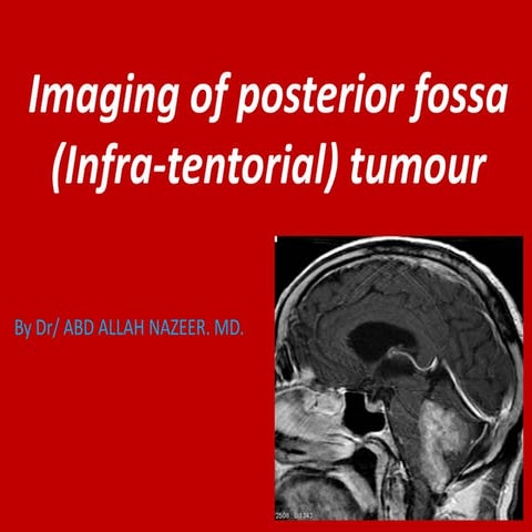 Presentation2.pptx. posterior fossa tumour