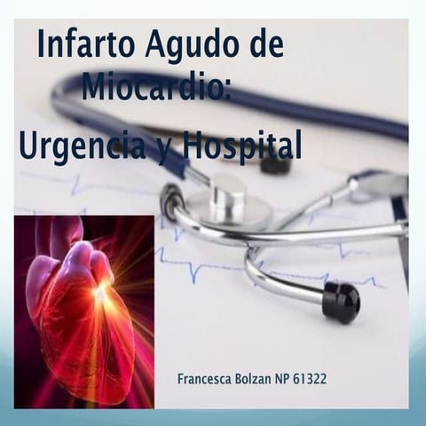 Infarto agudo de miocardio
