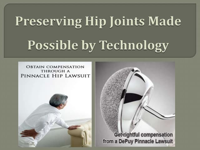 Preserving Hip Joints Made Possible by Technology