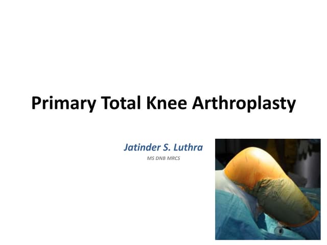 Primary total knee arthroplasty