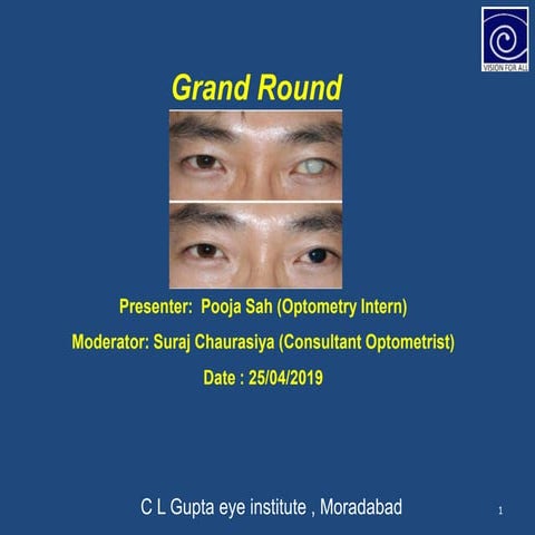 Prosthetic Contact Lens (Grand round)