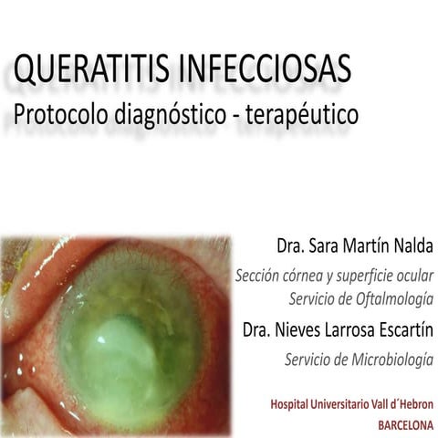 Queratitis infecciosas protocolo diagnostico terapeutico