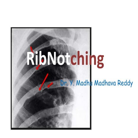Rib notching 