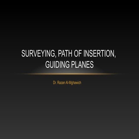 removable partial denture survey lines, path of insertion, guide planes