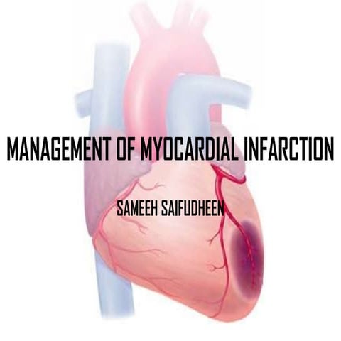 MYOCARDIAL INFARCTION-MANAGEMENT