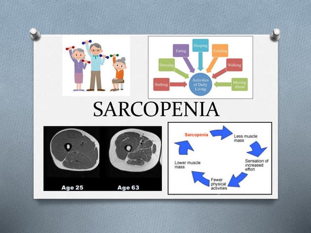 Sarcopenia - identifying, measuring and managing muscle loss in elderly popul...