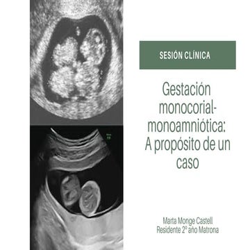 Gestación monocorial-monoamniótica: A propósito de un caso