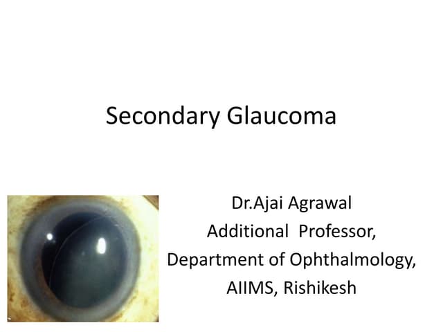 Secondary-glaucoma-Final.pptx