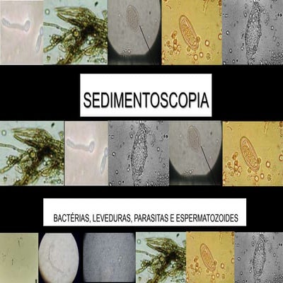 Sedimentoscopia - contaminantes/artefatos
