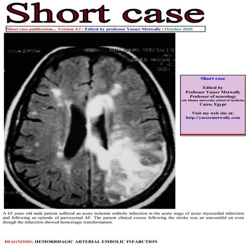 Short case...Arterial embolic hemorrhagic infarction
