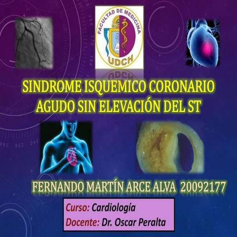 Sindrome coronario agudo sin elevacion segmento st