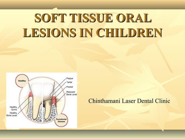 Soft tissue oral lesions in children