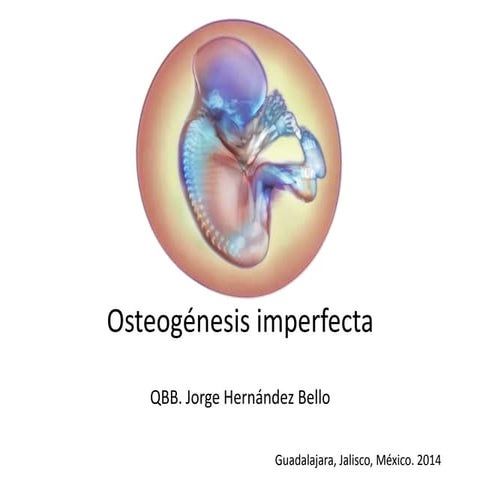 Osteogenesis imperfeta