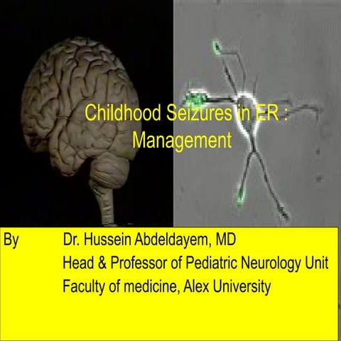 childhood  seizures and epilepsy for medical students 