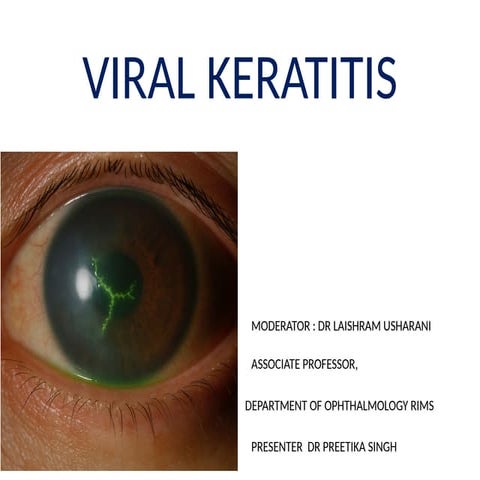Supplemented_Viral_Keratitis_60_Slides 24.pptx