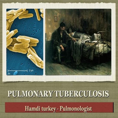 Pulmonary Tuberculosis 