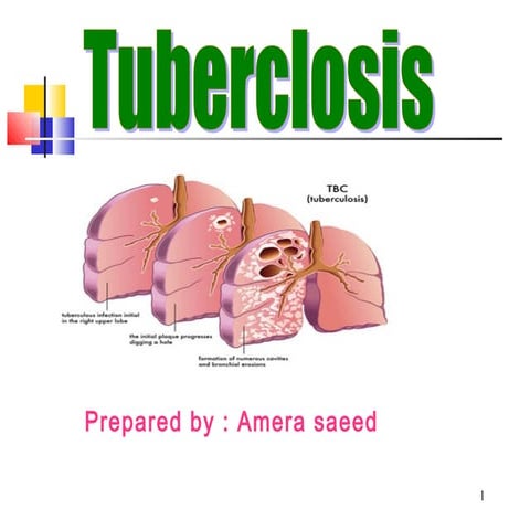 Tuberclosis