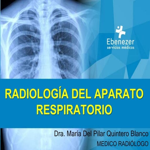 Radiología del Aparato Respiratorio