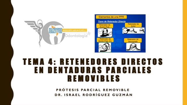 Retenedores directos en prótesis parcial removible