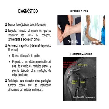 Tendinitis dx tto. (1)