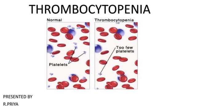 Thrombocytopenia