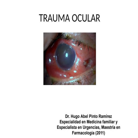 MR M KRLRKTRAUMA OCULAR ALFREDO CRUZ.pptx