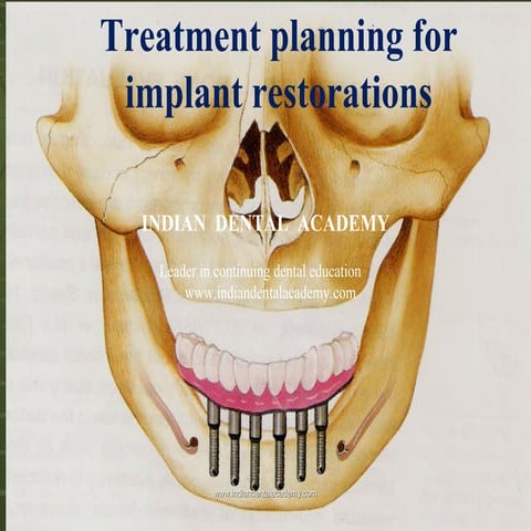 Treatment planning for implants/fixed orthodontics courses