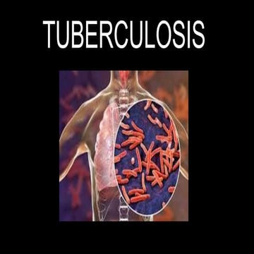 Tuberculosis 