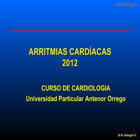 Arritmias