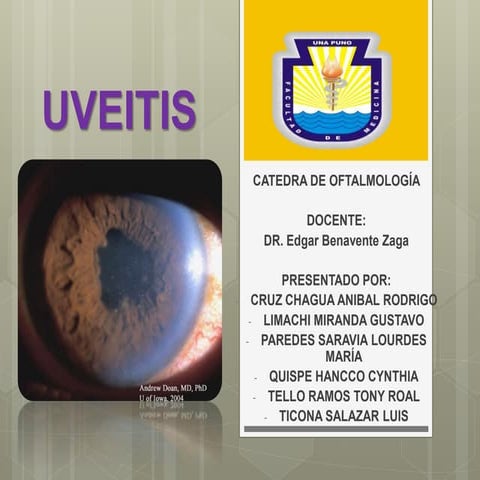 Uveitis oftalmologia