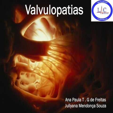 Valvulopatias  