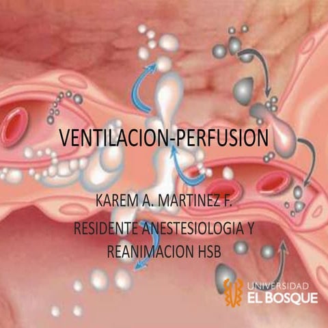 Ventilacion perfusion