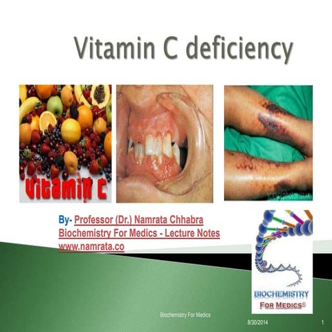 Vitamin C deficiency