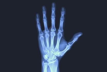 X Ray image