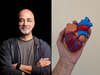 'Daily 5 km running and healthy habits didn’t stop my heart block': Man reveals lessons that saved his life:Image