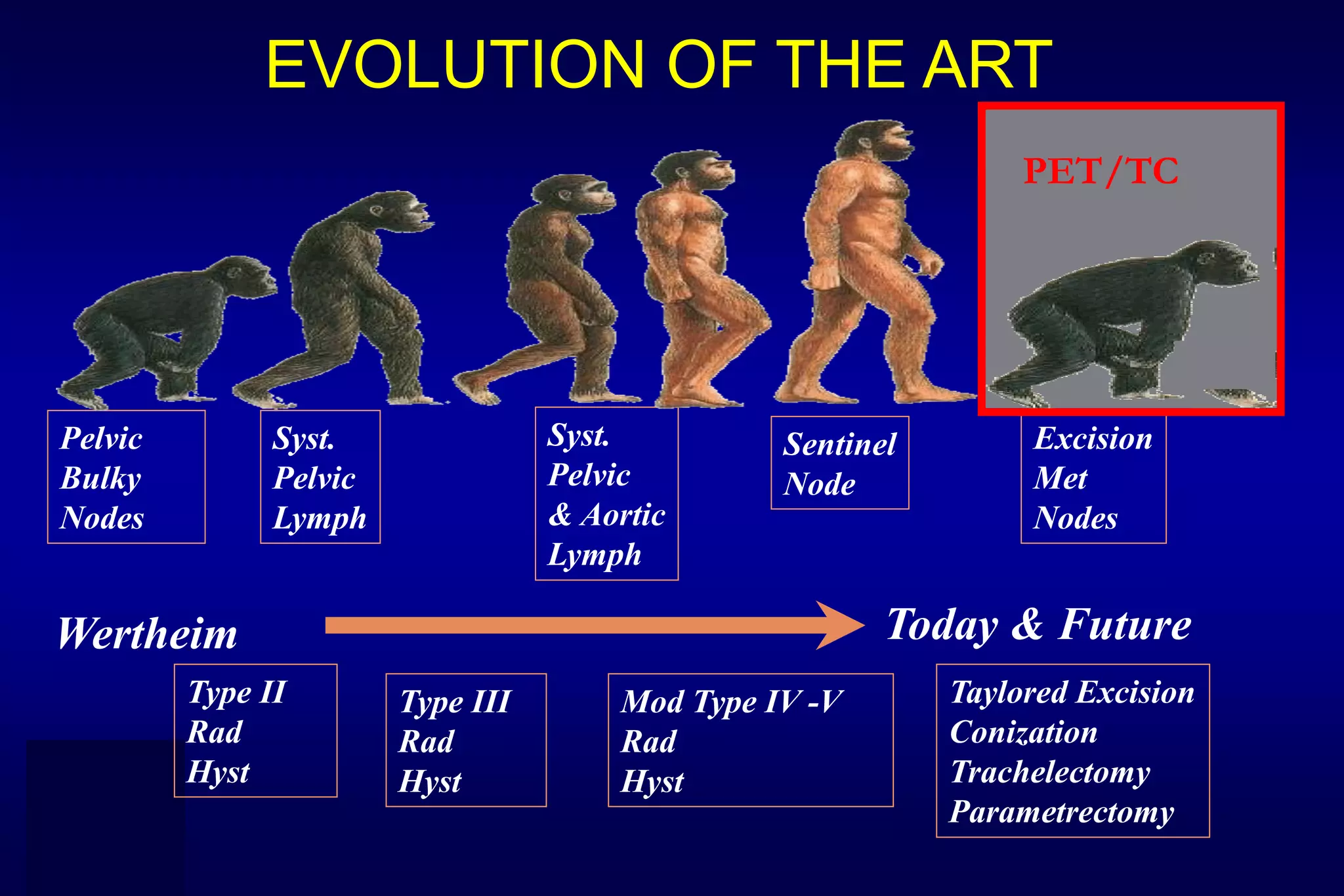 Wertheim
Pelvic
Bulky
Nodes
Type II
Rad
Hyst
Syst.
Pelvic
Lymph
Type III
Rad
Hyst
Syst.
Pelvic
& Aortic
Lymph
Mod Type IV -V
Rad
Hyst
Sentinel
Node
Taylored Excision
Conization
Trachelectomy
Parametrectomy
Excision
Met
Nodes
Today & Future
EVOLUTION OF THE ART
PET/TC
 