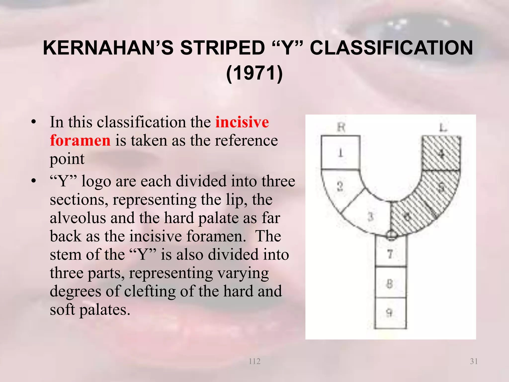 KERNAHAN’S STRIPED “Y” CLASSIFICATION
(1971)
• In this classification the incisive
foramen is taken as the reference
point
• “Y” logo are each divided into three
sections, representing the lip, the
alveolus and the hard palate as far
back as the incisive foramen. The
stem of the “Y” is also divided into
three parts, representing varying
degrees of clefting of the hard and
soft palates.
31112
 