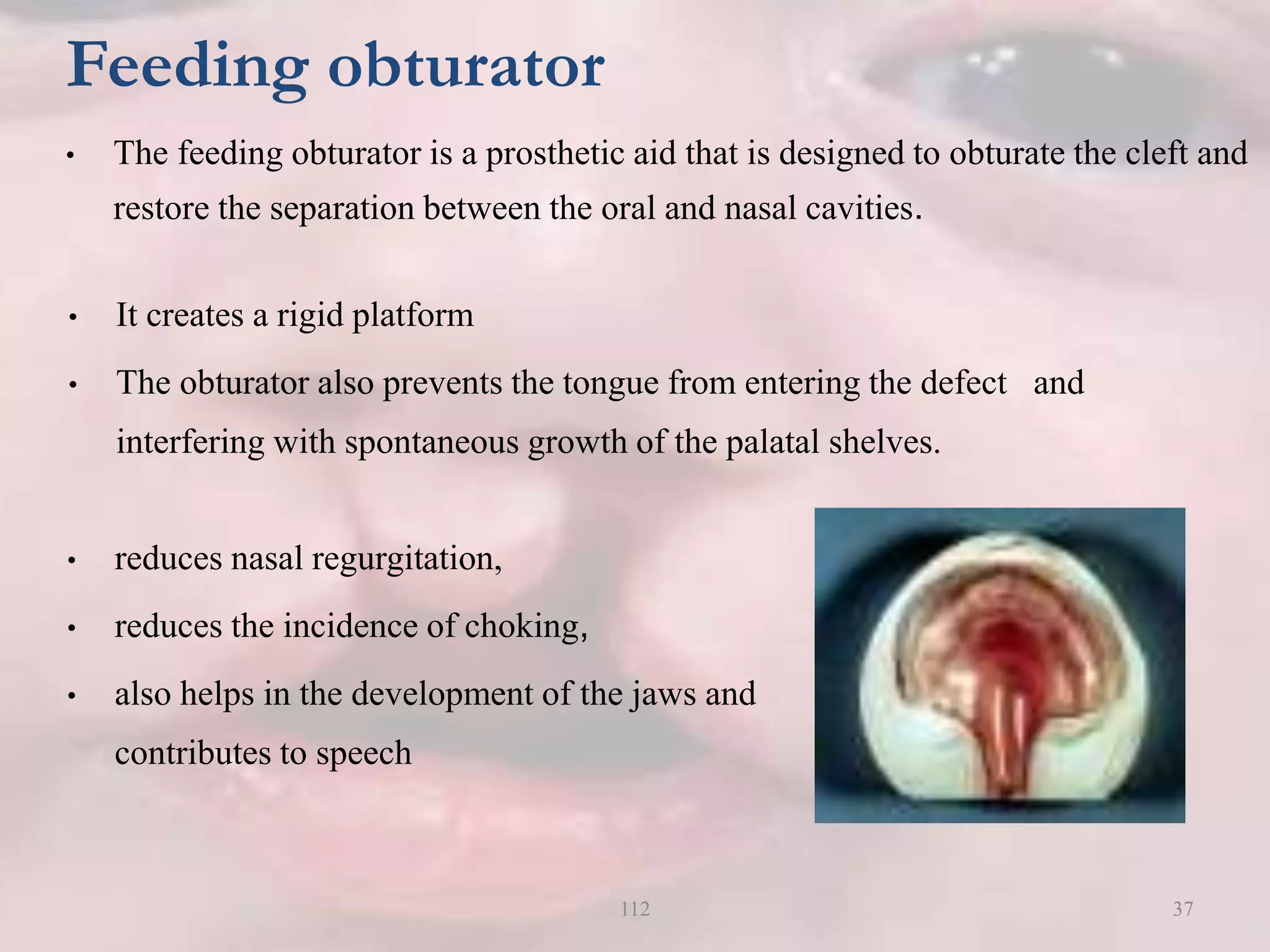 Feeding obturator
• The feeding obturator is a prosthetic aid that is designed to obturate the cleft and
restore the separation between the oral and nasal cavities.
• It creates a rigid platform
• The obturator also prevents the tongue from entering the defect and
interfering with spontaneous growth of the palatal shelves.
• reduces nasal regurgitation,
• reduces the incidence of choking,
• also helps in the development of the jaws and
contributes to speech
37112
 